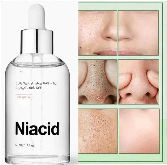 Niacid Face Serum 30ml – Brighten & Repair Skin